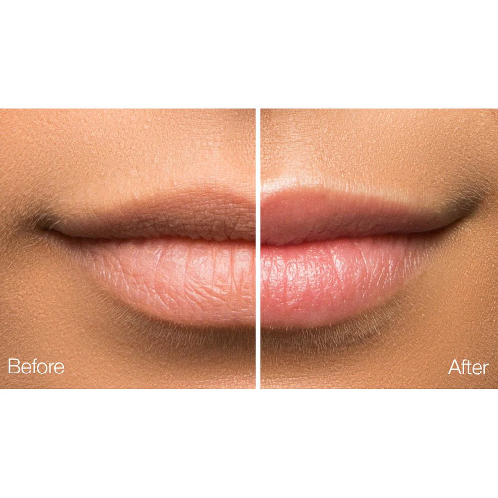 PHA 5% Exfoliating Lip Serum